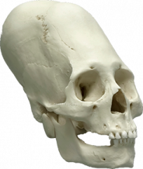 Horatio-skull.png
